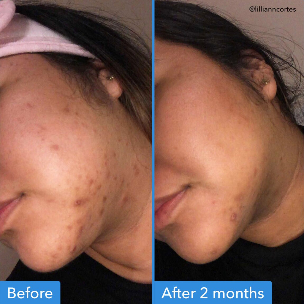 Good Molecules Discoloration Correcting Serum 30ml