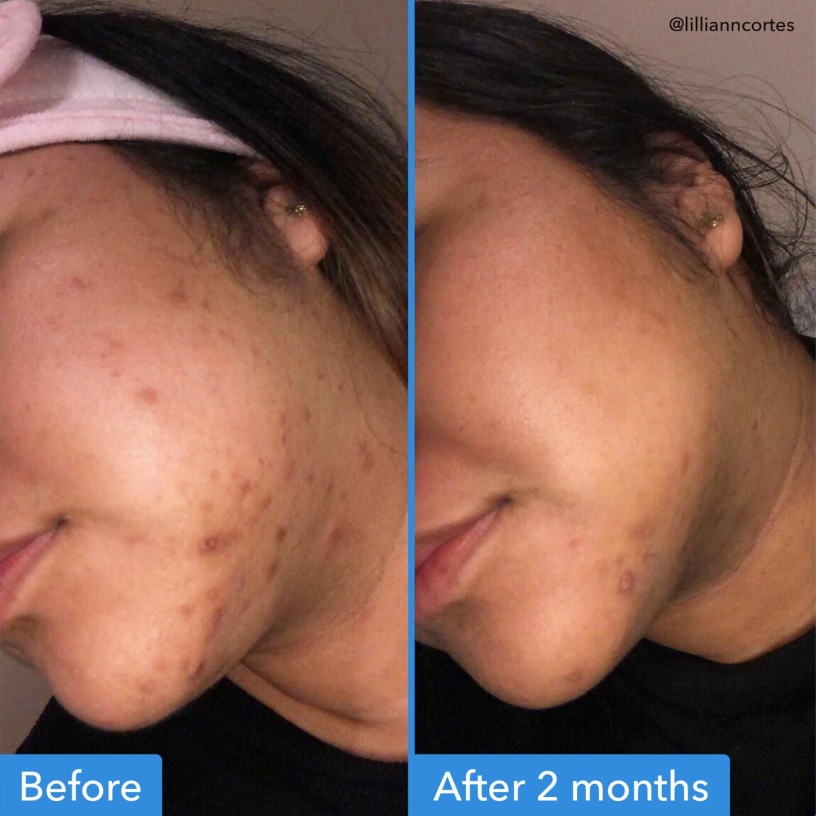 Good Molecules Discoloration Correcting Serum 30ml